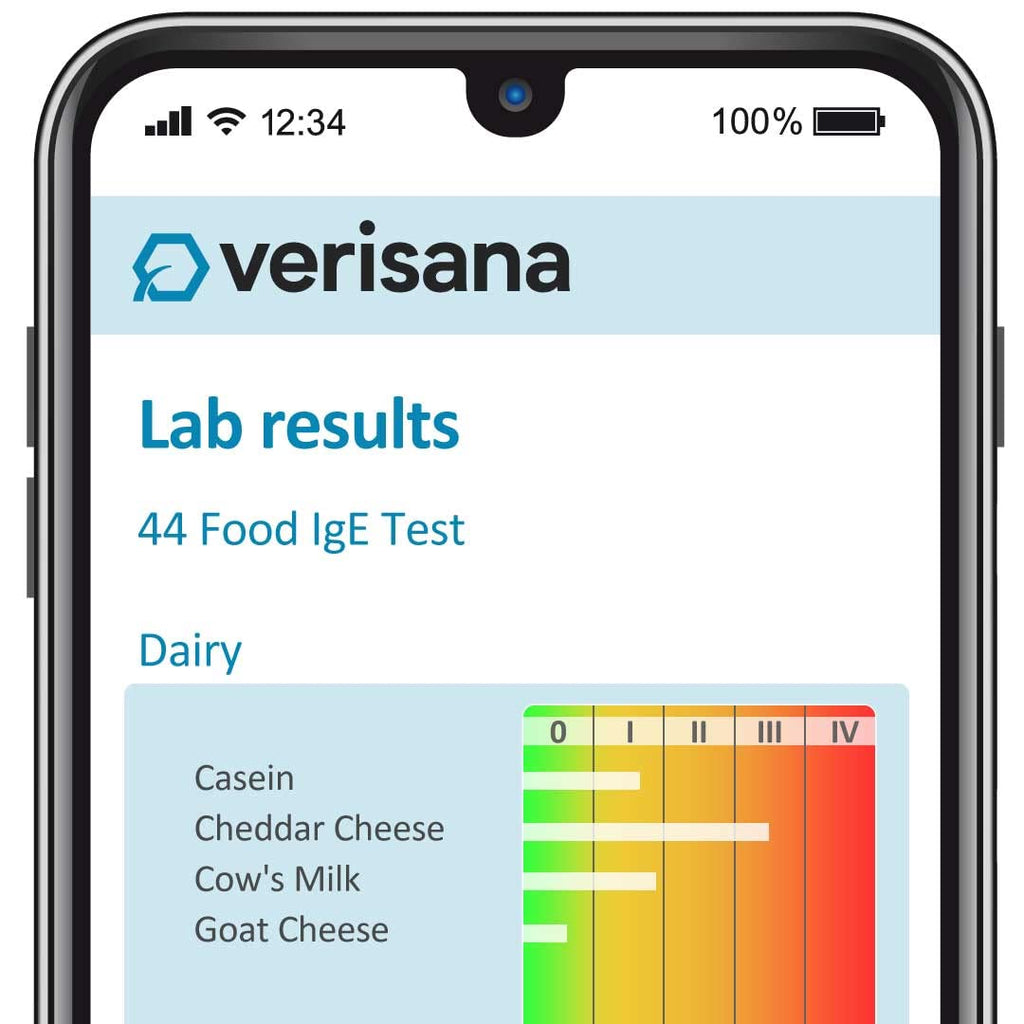 Food Allergy Test 44 Foods J3167